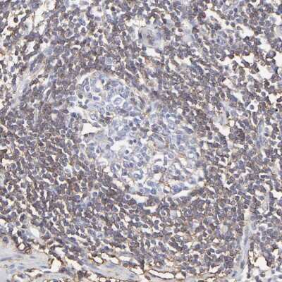 Immunohistochemistry-Paraffin: Annexin A6 Antibody [NBP1-90150]