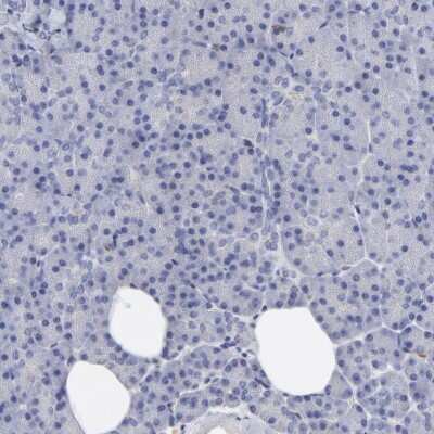 Immunohistochemistry-Paraffin: Annexin A6 Antibody [NBP1-90150]