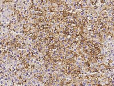 Immunohistochemistry-Paraffin: Annexin A6 Antibody [NBP2-98751]