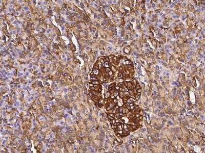 Immunohistochemistry-Paraffin: Annexin A6 Antibody [NBP2-99727]