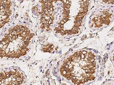 Immunohistochemistry-Paraffin: Annexin A6 Antibody [NBP2-99727]