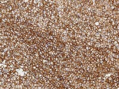 Immunohistochemistry-Paraffin: Annexin A6 Antibody [NBP2-99727]