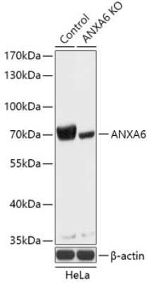 Knockout Validated: Annexin A6 Antibody - Azide and BSA Free [NBP3-03386]