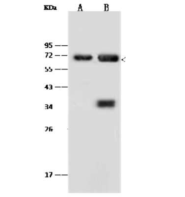 Western Blot: Annexin A6 Antibody [NBP2-99419]