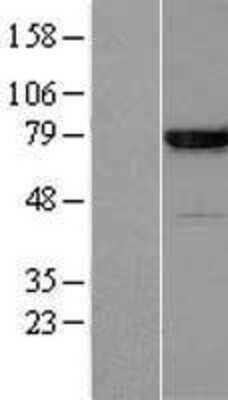 Western Blot: Annexin A6 Overexpression Lysate [NBP2-10557]