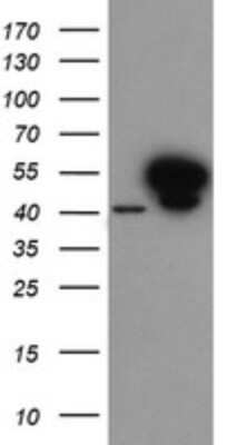 Western Blot: Annexin A7 Antibody (OTI1C3) [NBP2-45494]