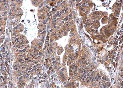 Immunohistochemistry-Paraffin: Annexin A7 Antibody [NBP1-31442]