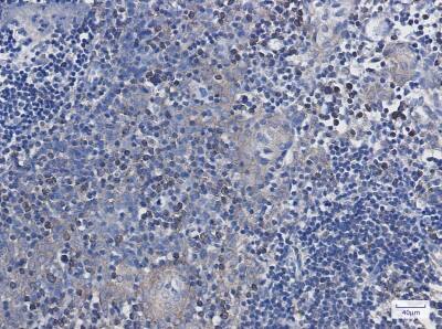 Immunohistochemistry-Paraffin: Annexin A7 Antibody (S07-1D2) [NBP3-19944]