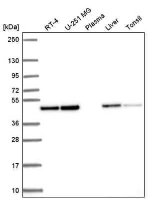 Western Blot: Annexin A7 Antibody [NBP2-57620]