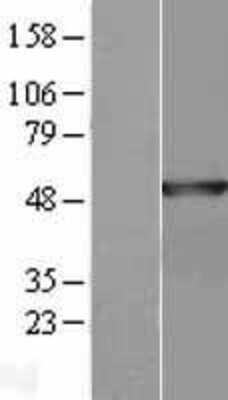 Western Blot: Annexin A7 Overexpression Lysate [NBL1-07567]