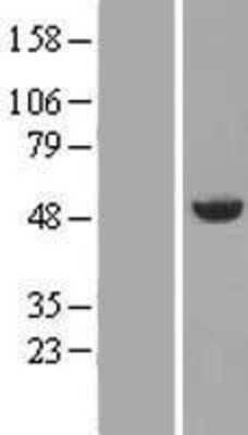 Western Blot: Annexin A7 Overexpression Lysate [NBP2-10558]