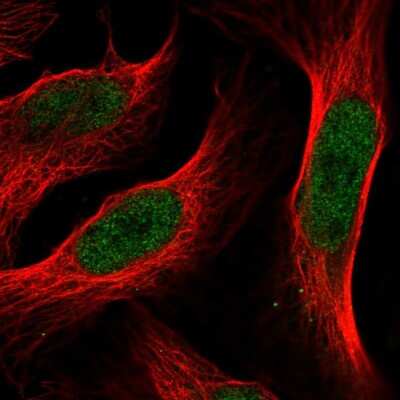 Immunocytochemistry/ Immunofluorescence: Annexin A8/ANXA8 Antibody [NBP2-55542]