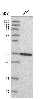 Western Blot: Annexin A8/ANXA8 Antibody [NBP2-57118]