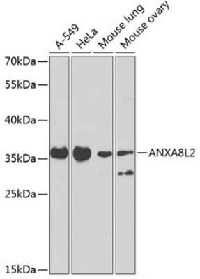 Western Blot: Annexin A8/ANXA8 AntibodyBSA Free [NBP3-05654]