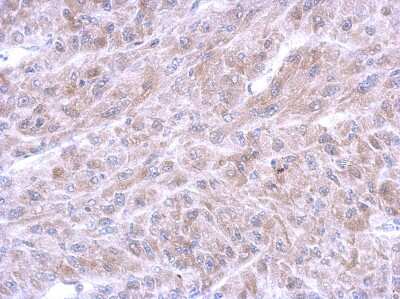 Immunohistochemistry-Paraffin: Annexin A8/ANXA8 Antibody [NBP2-15410]