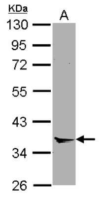 Western Blot: Annexin A8/ANXA8 Antibody [NBP2-15410]