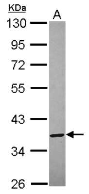 Western Blot: Annexin A8/ANXA8 Antibody [NBP2-15411]