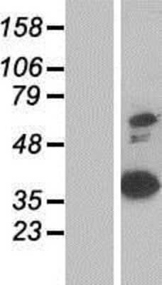 Western Blot: Annexin A8/ANXA8 Overexpression Lysate [NBP2-10633]