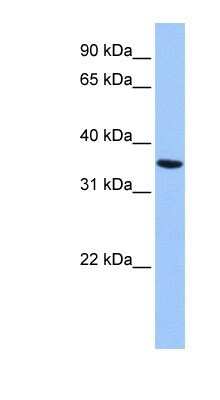 Western Blot: Annexin A8 like2 Antibody [NBP1-59127]