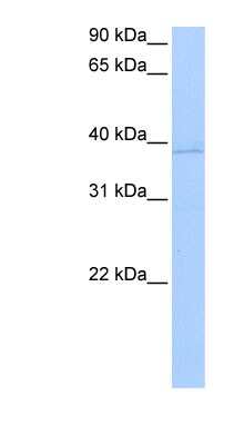 Western Blot: Annexin A8 like2 Antibody [NBP1-59128]