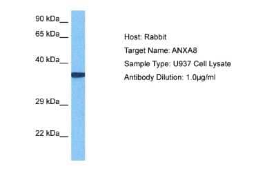 Western Blot: Annexin A8 like2 Antibody [NBP2-86575]