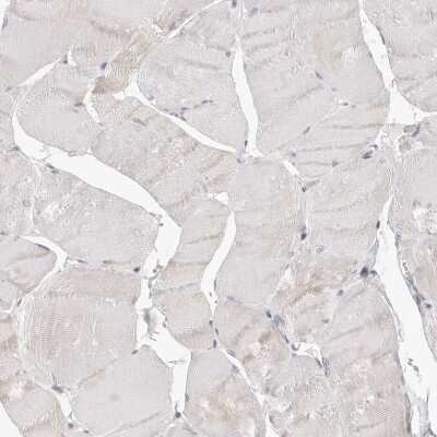 Immunohistochemistry-Paraffin: Annexin A9 Antibody [NBP1-90152]