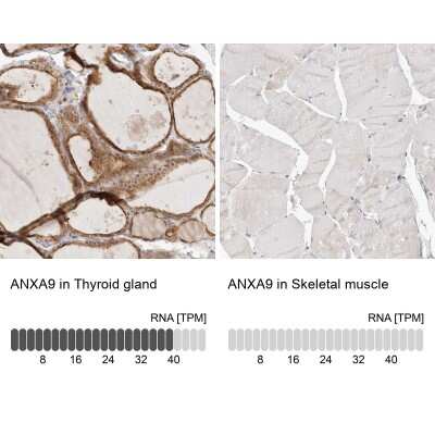 Immunohistochemistry-Paraffin: Annexin A9 Antibody [NBP1-90152]