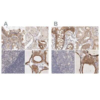 Immunohistochemistry-Paraffin: Annexin A9 Antibody [NBP1-90152]