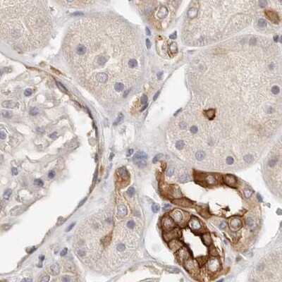 Immunohistochemistry-Paraffin: Annexin A9 Antibody [NBP1-90152]