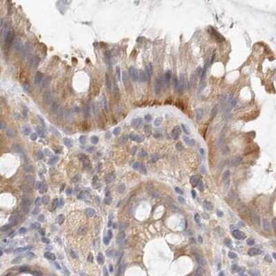 Immunohistochemistry-Paraffin: Annexin A9 Antibody [NBP1-90152]