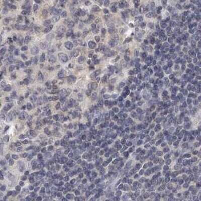Immunohistochemistry-Paraffin: Annexin A9 Antibody [NBP1-90152]