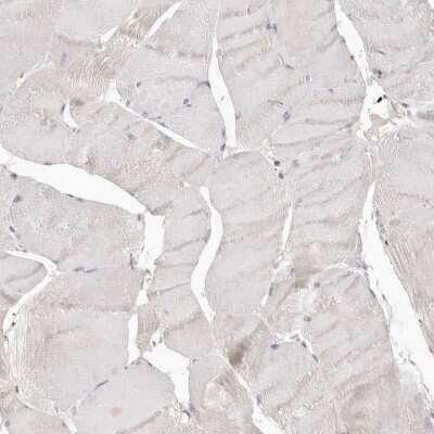 Immunohistochemistry-Paraffin: Annexin A9 Antibody [NBP1-90153]