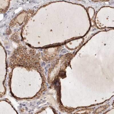 Immunohistochemistry-Paraffin: Annexin A9 Antibody [NBP1-90153]