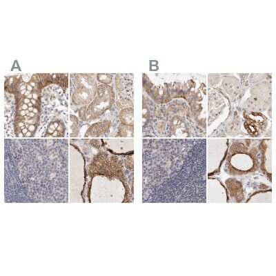 Immunohistochemistry-Paraffin: Annexin A9 Antibody [NBP1-90153]