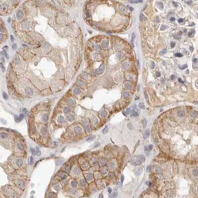 Immunohistochemistry-Paraffin: Annexin A9 Antibody [NBP1-90153]