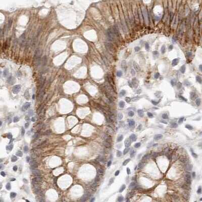 Immunohistochemistry-Paraffin: Annexin A9 Antibody [NBP1-90153]