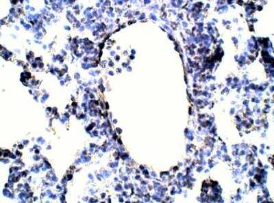 Immunohistochemistry-Paraffin: Annexin A9 Antibody [NBP3-12451]