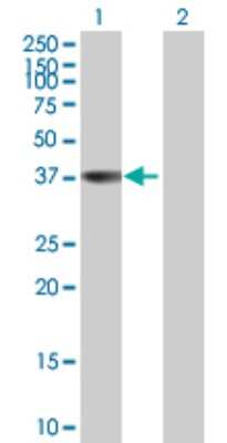 Western Blot: Annexin A9 Antibody [H00008416-B01P]