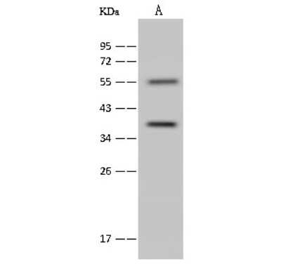 Western Blot: Annexin A9 Antibody [NBP2-99556]