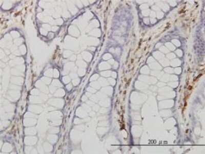 Immunohistochemistry-Paraffin: Annexin V Antibody (1F4-1A5) [H00000308-M01]