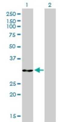 Western Blot: Annexin V Antibody (1F4-1A5) [H00000308-M01]