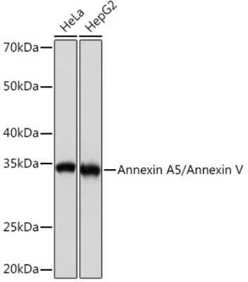 Western Blot: Annexin V Antibody (9A5M8) [NBP3-16795]