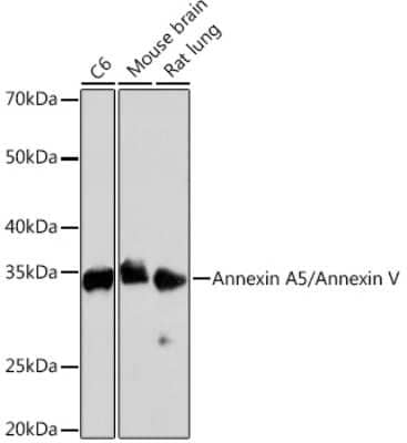 Western Blot: Annexin V Antibody (9A5M8) [NBP3-16795]