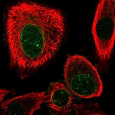 Immunocytochemistry/ Immunofluorescence: Annexin V Antibody [NBP2-38248]