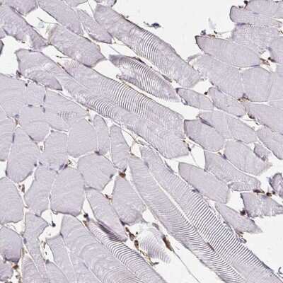 Immunohistochemistry-Paraffin: Annexin V Antibody [NBP2-38248]