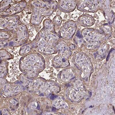 Immunohistochemistry-Paraffin: Annexin V Antibody [NBP2-38248]
