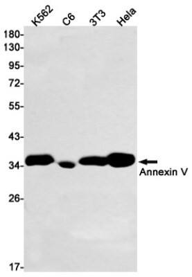 Western Blot: Annexin V Antibody (S08-3A4) [NBP3-19543]