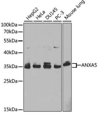 Western Blot: Annexin V AntibodyBSA Free [NBP2-92940]