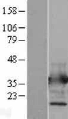 Western Blot: Annexin V Overexpression Lysate [NBL1-07565]