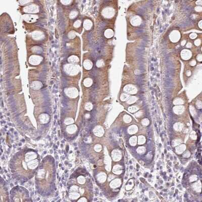 Immunohistochemistry-Paraffin: Anoctamin-9 Antibody [NBP2-14298]